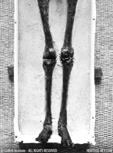 King Tut's legs